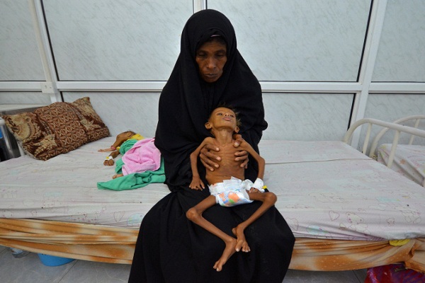 Saudi Blockade Hindering Aid Delivery to Starving Yemenis: UN